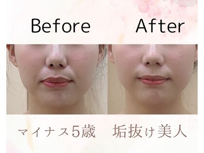 オリナサツキ(OlinaSatsuki)の写真