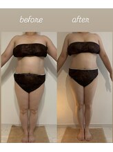 ベル/フォースカッター 80分 5回