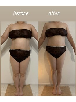 ベル/フォースカッター 80分 5回