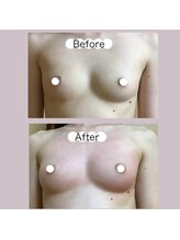 アップオー 小倉店(up・O)/体験者様　施術例