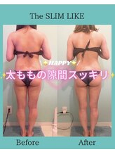 スリムライク 鳥取店(The SLIM LIKE)/痩身ビフォーアフター