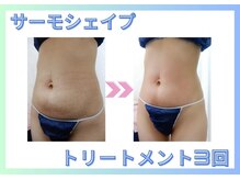 エルクレスト 新宿店/気になる部分にアプローチ