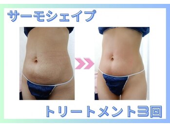 エルクレスト 新宿店/気になる部分にアプローチ