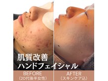 ララピールの進化版！日韓話題の『セラピール』早期導入♪