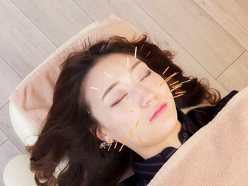 福岡博多美容鍼灸院ハリナチュレ【小顔矯正/美容鍼/リフトアップ/ララピール】の写真/小顔を目指しながら、身体の疲れも取りたい方必見◎ブライダル前のお手入れにも♪[美容鍼/小顔/整体]