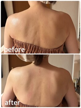 ジフィー(Gify)/肩こり首こり改善、肩甲骨でます