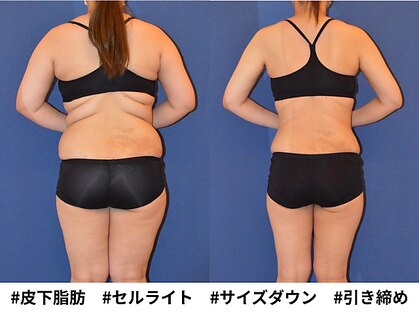 ピュアノア 垂水店の写真