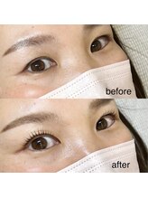 ビオールイースト(Be All east)/根元からばっちり立ち上げ◎