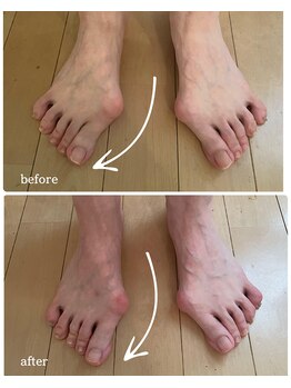 ココン フワット(cocon fouato)/足指矯正親指の角度に注目！銀座