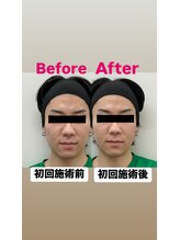 ゆうはり鍼灸整骨院 恵比寿/お客様Before　After
