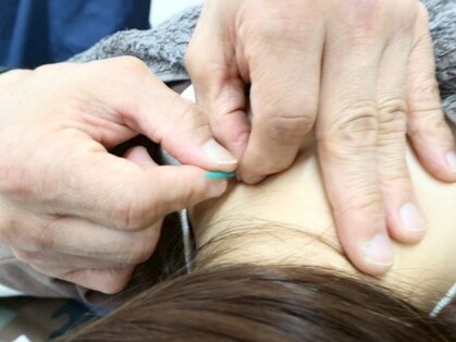 よしゆき鍼灸院の写真