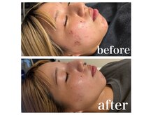 シード(SHE°)の雰囲気(★ハーブピーリング/ホワイトニング/耳ツボジュエリー/小顔)