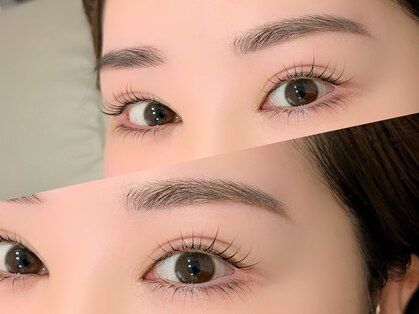 フォルミー(forume)の写真