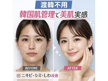 アロハ美容整体院 花巻店/再生美容ケア