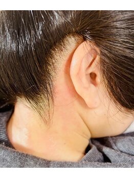 エミレ(emire)の写真/【《うなじset》VIOブラジリアンワックス脱毛&パック+うなじ脱毛¥8800】チクチク生えないダメージレス脱毛