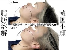 エステティック リベル キョウト 京都駅前店(Esthetic Liber Kyoto)/韓国小顔コルギ×脂肪分解
