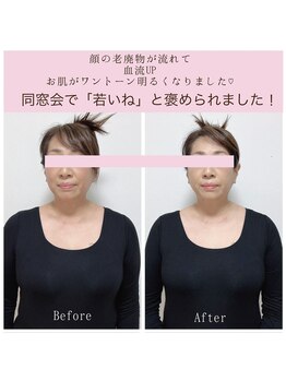 ビーホリック(Bholic)/フェイスラインもたつき、クスミ