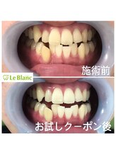 ルブラン 奈良店(Le Blanc)/男性のお客様も女性に負けず！！