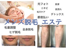 マハロ(MAHALO)の雰囲気（メンズメニューもたくさんあります!ヒゲ脱毛大人気です♪）