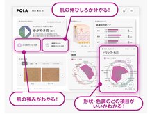 ポーラ らいす店(POLA)/私の肌の傾向が解る肌分析結果