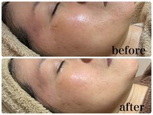 フェイシャルサロン アリイ(ALII)/