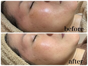 フェイシャルサロン アリイ(ALII)/