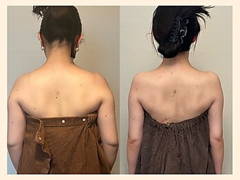 ラフリー 西宮北口院(RUFFREE)/すっきり背中美人に【西宮】