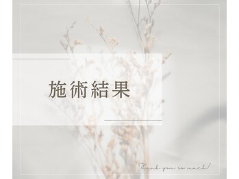 クレビア(Clevia)/Clevia-クレビア