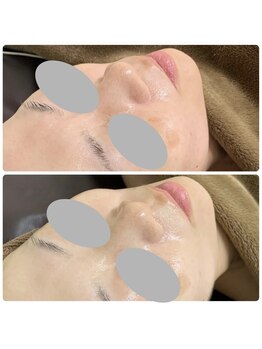 ルタンリッシュ ハナレ(Lutan Riche 花麗)/