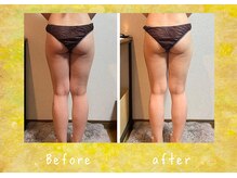 マタハリ(Matahari)/4D筋膜リリース