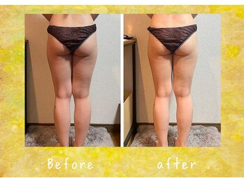 マタハリ(Matahari)/4D筋膜リリース