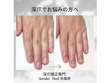 アウェイク ネイル(Awake Nail)