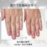 アウェイク ネイル(Awake Nail)
