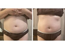 リムアール(Limh R)/