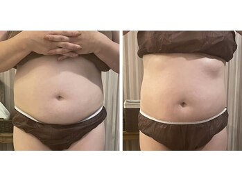 リムアール(Limh R)/