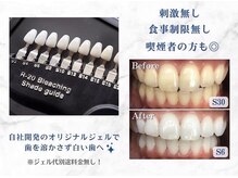 ホワイトニングショップ 各務原店