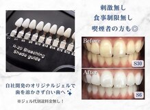 ホワイトニングショップ 各務原店