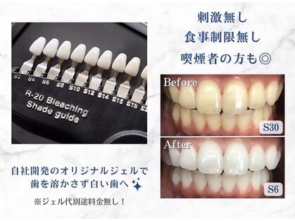 歯のホワイトニング専門店　ホワイトニングショップ各務原店【6/4 NEW OPEN（予定）】の写真
