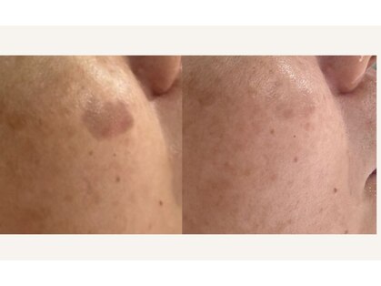 グロウスキン(GROW SKIN)の写真