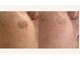 グロウスキン(GROW SKIN)の写真