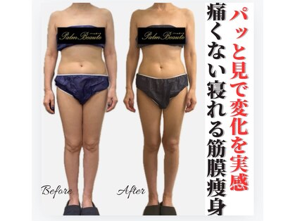 パームボーテ(Palm Beaute)の写真