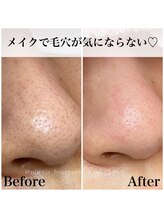 フワットン(Fouatons)/