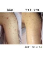 スリリアン 銀座/★お客さまビフォーアフター★