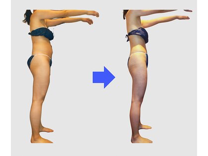 ネオボディ(Neo Body)の写真