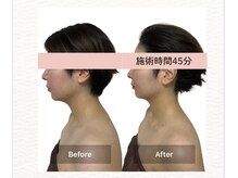 リノリー(rinory)の雰囲気（立体的な小顔づくり）