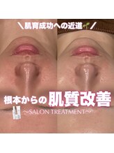 ジェノール 2nd beauty studio 姫路駅前店(JNOEL)/根本からの肌質改善！