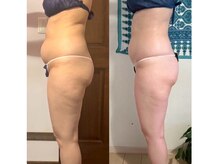 ラビーバ(Ravviva)