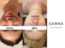 カルナ(CARNA)/【肌質改善専門店】CARNA