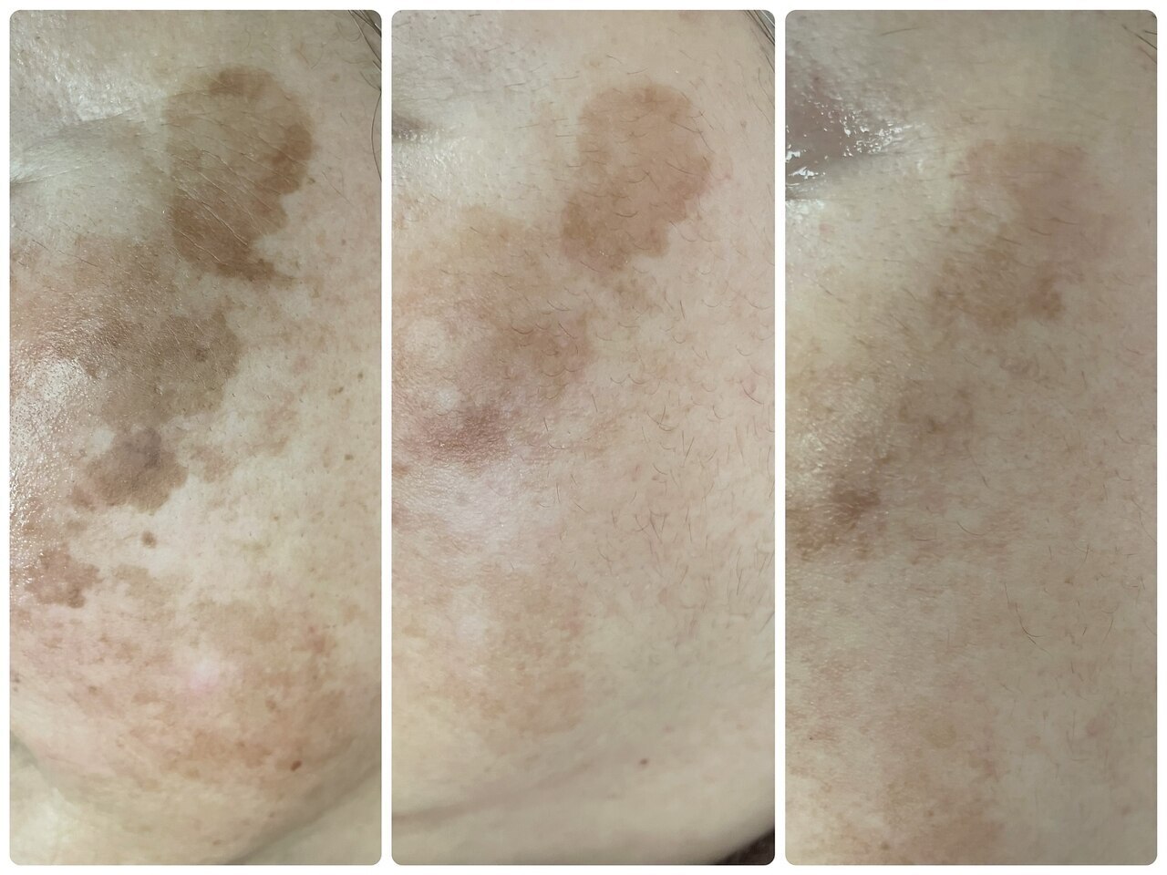 ポードランジェ(Peau de L`ange)｜ホットペッパービューティー