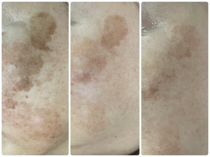 ポードランジェ(Peau de L`ange)の写真